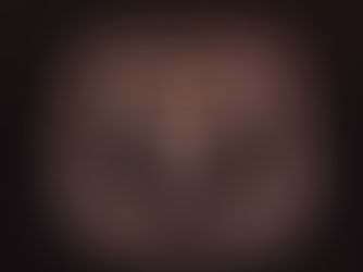 Vysoký tlak už nemajú len starí rodičia 💓 2000 detí na Slovensku sa lieči na "silent killer"