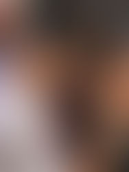 PT-141 (Bremelanotide)