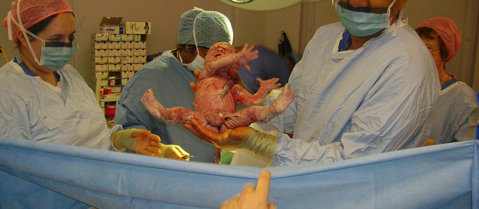 Why Caesarean Births Can Still Feel Empowering