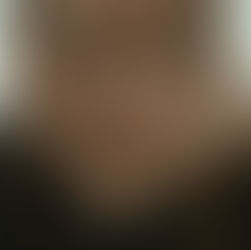 Here's why watching those who ignore social distancing reminds me of my invincibility