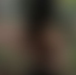 Return-to-Sport-Kriterien für Schulterverletzungen