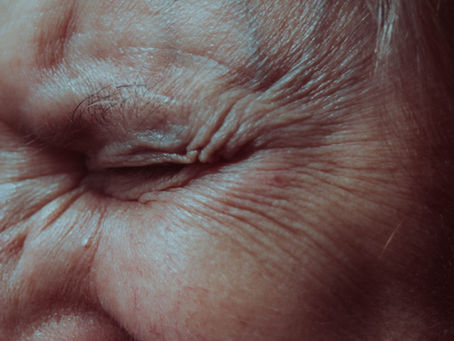 Doença de Parkinson também afeta a visão e exige atenção oftalmológica