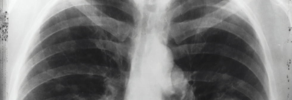 Image by National Cancer Institute