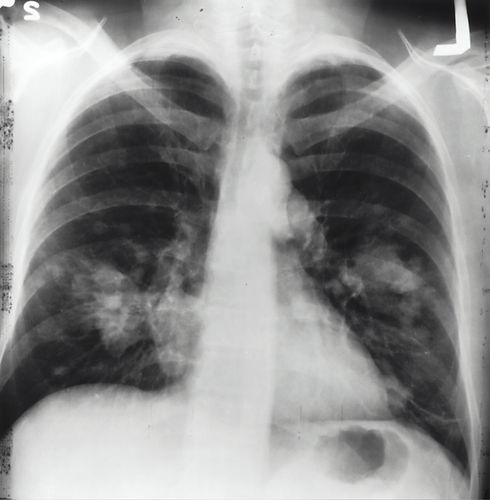 Image by National Cancer Institute