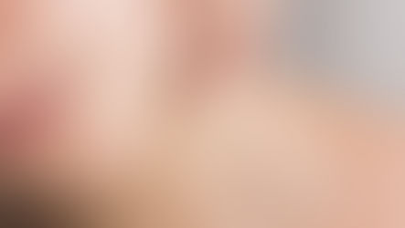 Are All Dermatologists Just Guessing?