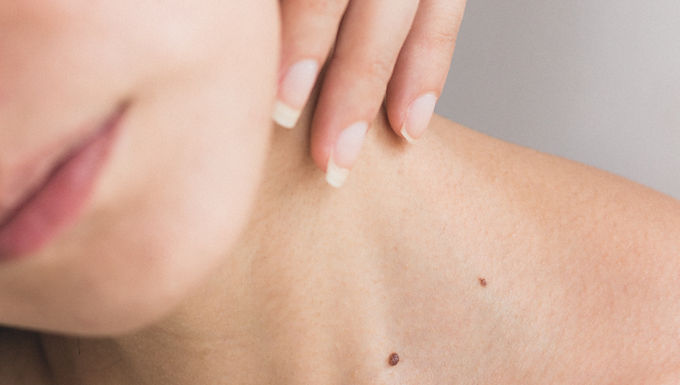 Your Skin Health Consultation