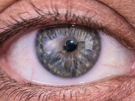 How To Overcoming Contact Lens Discomfort