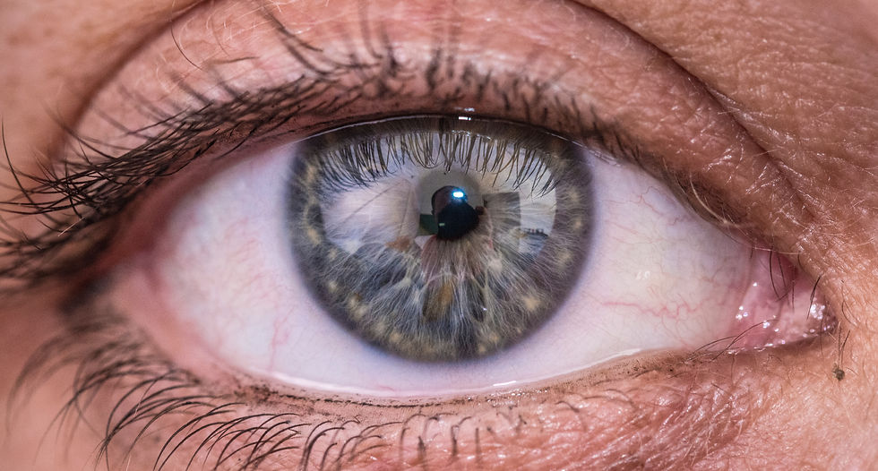 How To Overcoming Contact Lens Discomfort