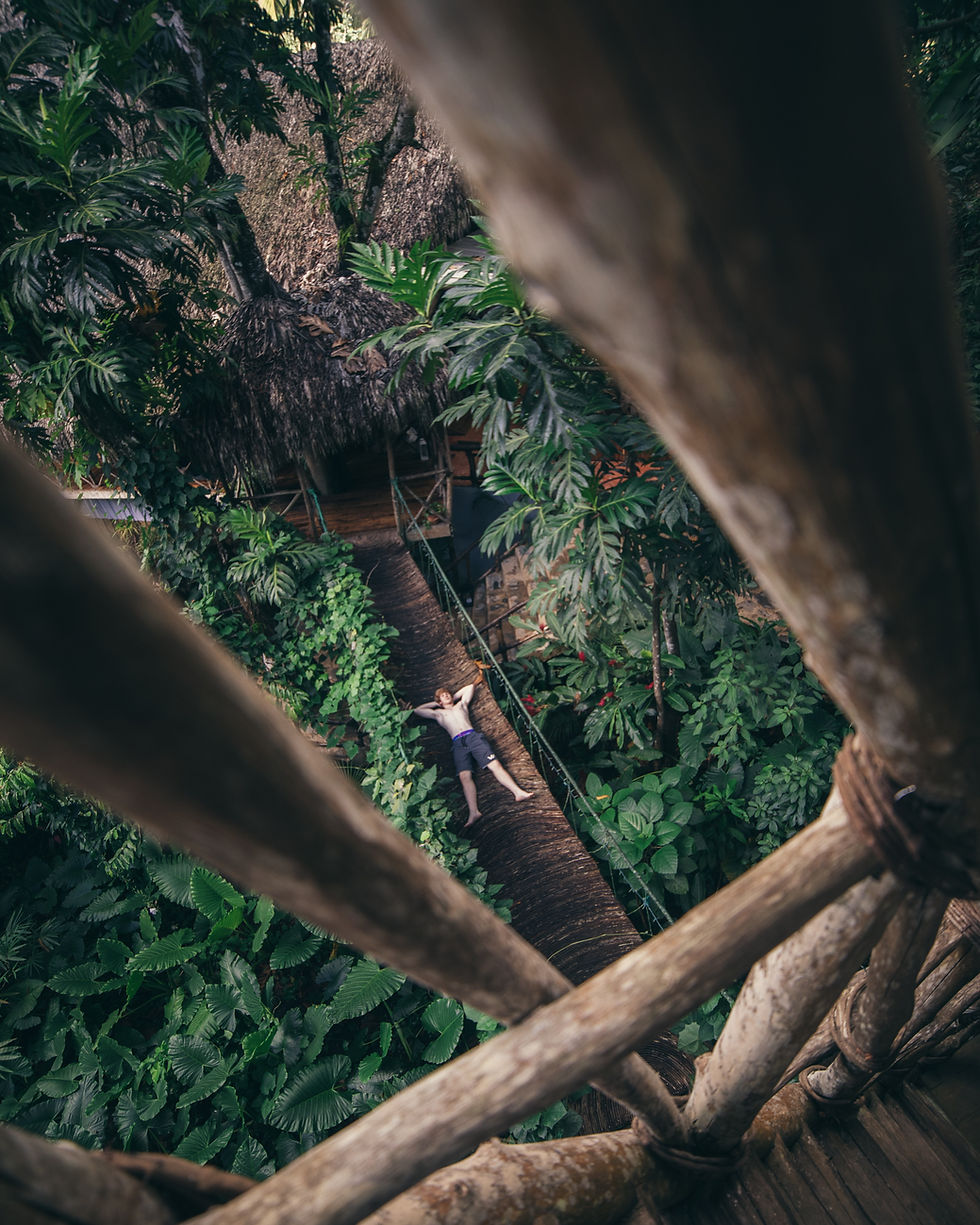 A man relaxing at a treehouse