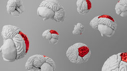 Floating white brain models with red highlighted regions on a gray background, showing a medical neurology concept.