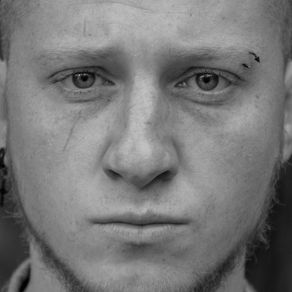 challenge chiamata “Cicatrice francese”