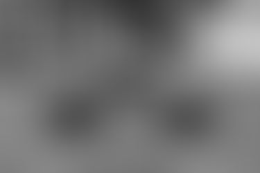 Mud Fever in Horses: Causes, Treatment, and When to Call the Vet