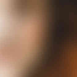 Woman with skin pigment