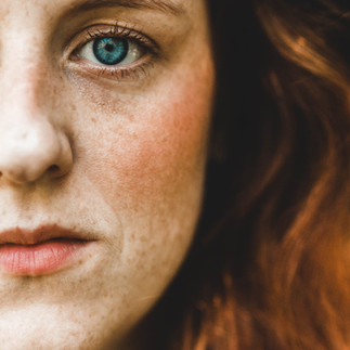 Woman with skin pigment