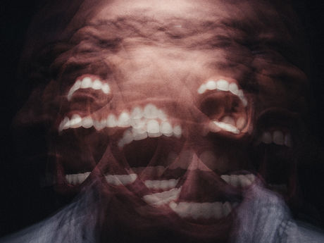 ¿Porqué me duele la cara?