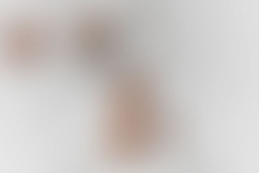 Milk Alternatives for Lactose Intolerance and Dairy Allergies