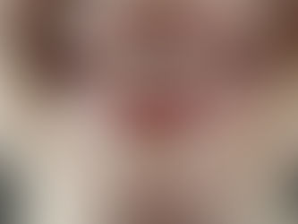 Boyun ağrının sebebi diş sıkmak olabilir mi?