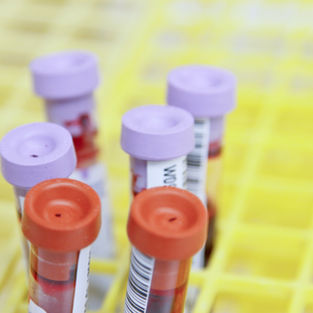 blood tests