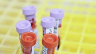Why Blood Tests Are Important for Monitoring Your Horse’s Health