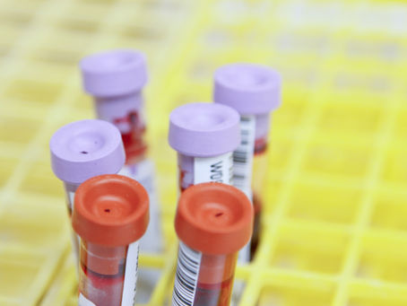 - What is leptin resistance?