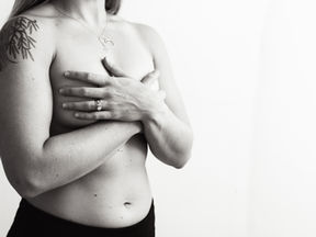 Clinical Complications of Chemotherapy and Patient-Reported Outcomes After Breast Reconstruction