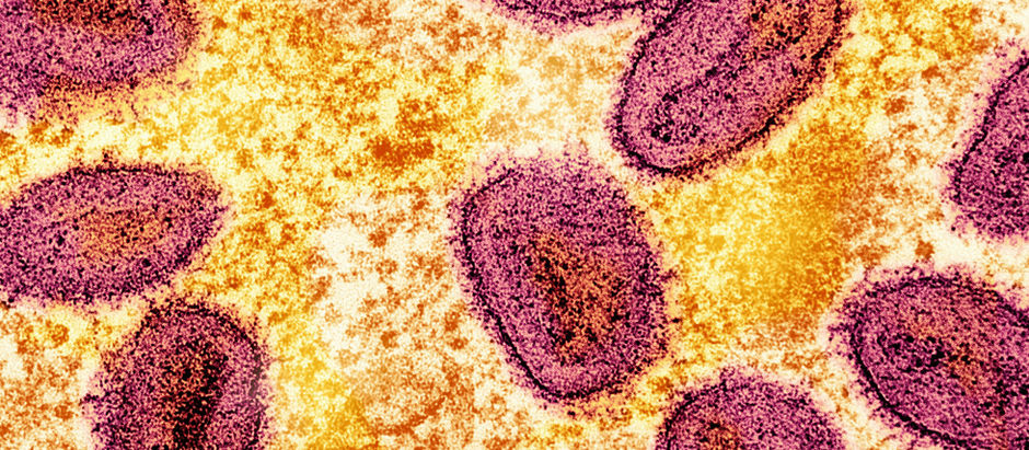 Mpox