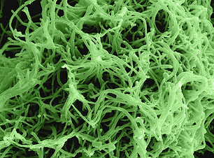 Image by National Institute of Allergy and Infectious Diseases