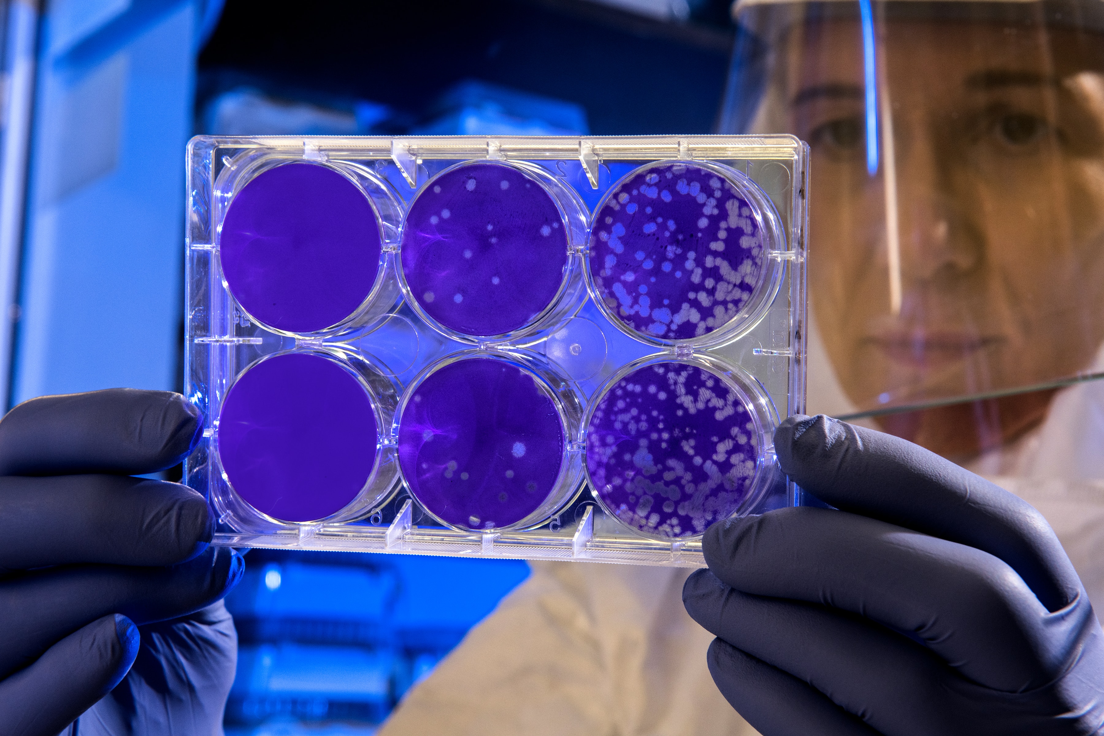 IA generativa desarrolla antibióticos efectivos contra bacterias resistentes en ratones