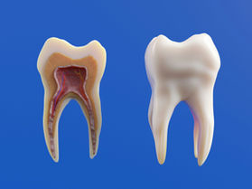 Do I Need a Root Canal? Everything You Need to Know Before Your Appointment