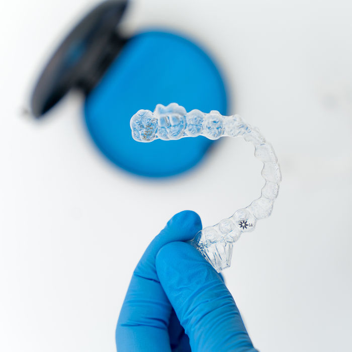 Invisalign Bangalore