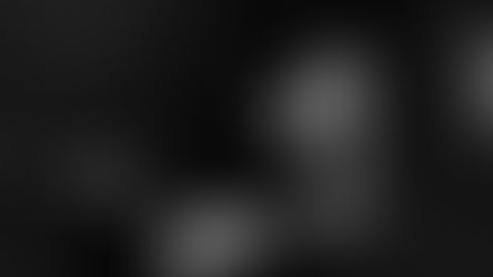 Is RSD the smoking gun?