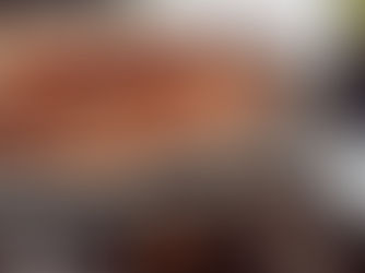 Giải oan cho "kẻ thù" của tim mạch: Thực phẩm giàu cholesterol có thật sự nguy hại?