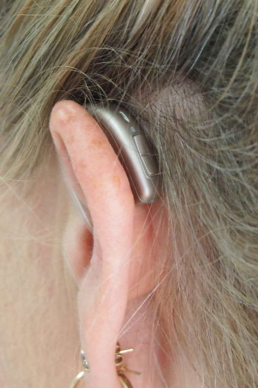woman with hearing aid