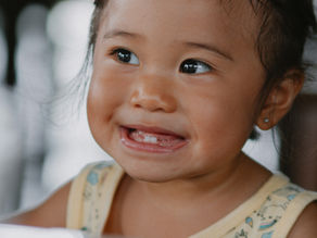 Bottle Feeding & Cavities: What Parents Often Miss About Baby Tooth
