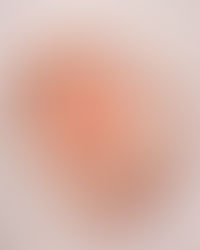 Half a Decade and 10 Specialists Later, Mystery (Maybe) Solved 🫠🙏