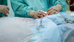 Day 4 Post-Op (Part I)