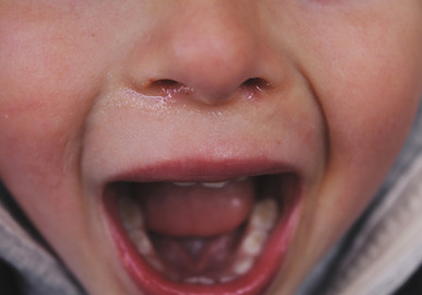 Boy crying