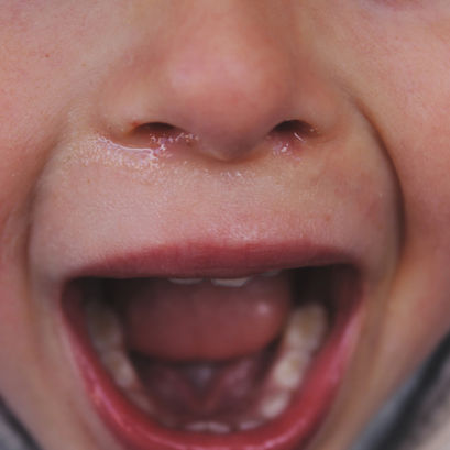 The Sensory Side of Tantrums: What’s Really Happening in Your Child’s Brain