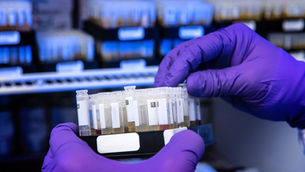 Identifying Risks in Clinical Trial Supplies and Comparator Sourcing