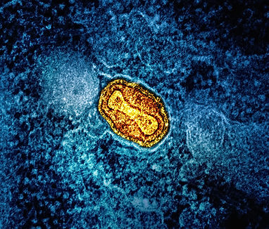 Image de National Institute of Allergy and Infectious Diseases