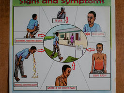 UsFDA Guidance: Recommendations for Assessment of Blood Donor Eligibility, Donor Deferral and Blood Product Management in Response to an Ebola Disease Outbreak