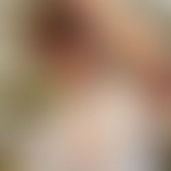 Image of a teen boy standing outside under a tree with his hand on his head | therapy for teens in manhattan, ny | therapy for teens in brooklyn, ny | teen therapist in new york, ny | anxiety in teens | online anxiety therapy | parenting therapy | 10605 | 11021 | 11050 | 10583 | 10010