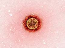 Measles Cases Continue To Rise In Pennsylvania