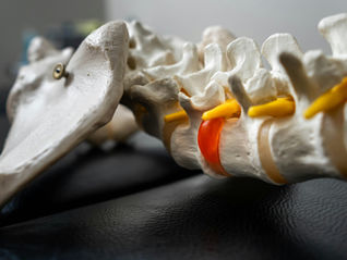 Osteoarthritis in spine
