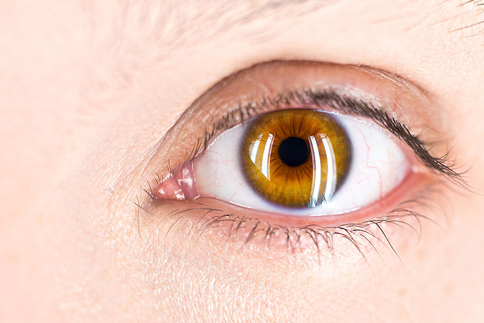 Photorefractive Keratectomy (PRK) in Queens and Brooklyn, NY - eye&I™ Optometry