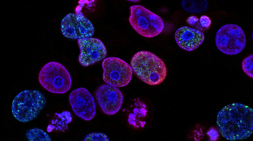 Image by National Cancer Institute