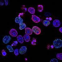 Image by National Cancer Institute