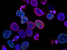 Immunotherapy - a Game Changer in Treating Cancer