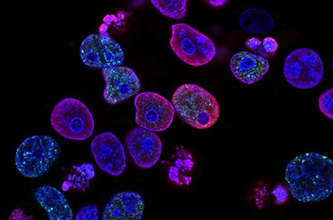Image by National Cancer Institute