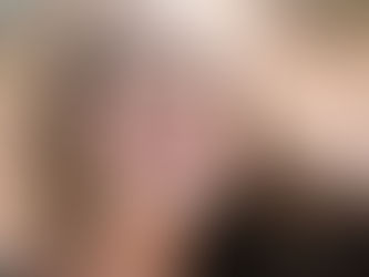 Diş Beyazlatma Dişlere Zarar Verir Mi?